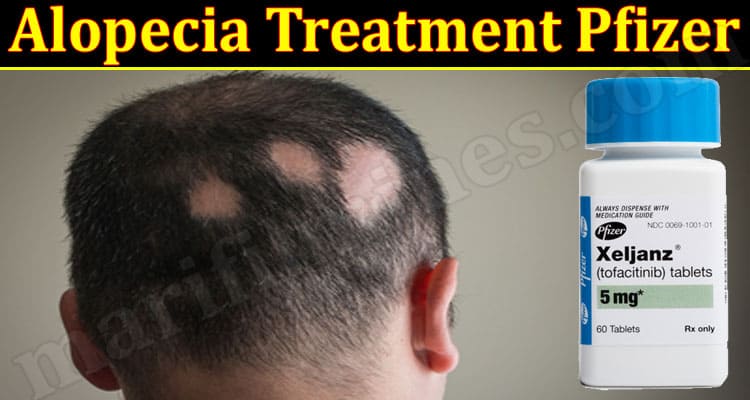 Latest News Alopecia Treatment Pfizer
