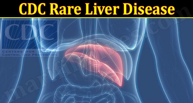 Latest News CDC Rare Liver Disease