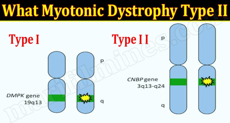 Latest News What Myotonic Dystrophy Type II