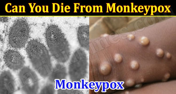 Latest News Can You Die From Monkeypox