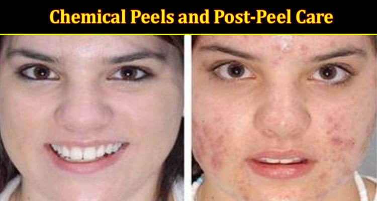 Skin Treatments: Chemical Peels and Post-Peel Care